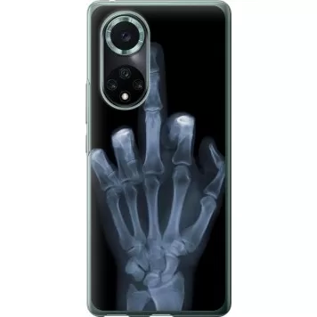 Чехол на Huawei Nova 9 Pro Рука через рентген