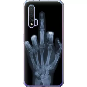 Чехол на Huawei Nova 6 Рука через рентген