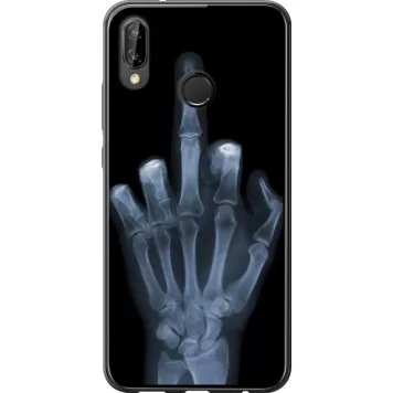 Чехол на Huawei P20 Lite Рука через рентген