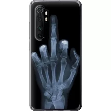 Чохол на Xiaomi Mi Note 10 Lite Рука через рентген