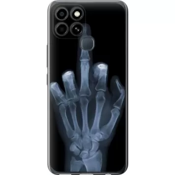 Чехол на Infinix Smart 6 Рука через рентген