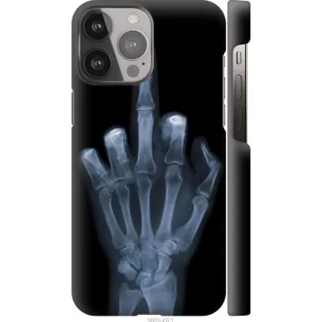 Чехол на iPhone 13 Pro Max Рука через рентген