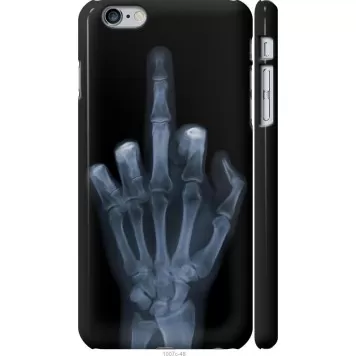 Чехол на iPhone 6 Plus Рука через рентген