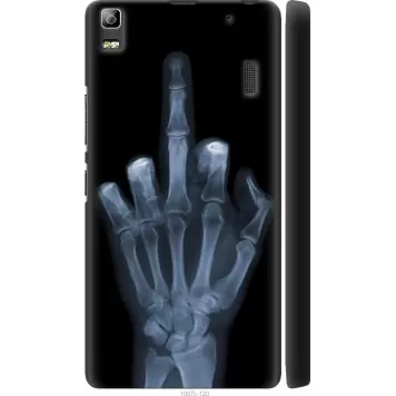 Чохол на Lenovo K3 Note K50-T5 Рука через рентген