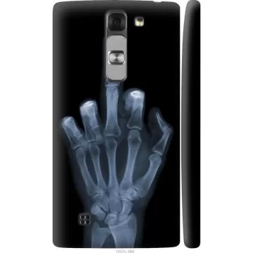 Чохол на LG G4c H522y Рука через рентген