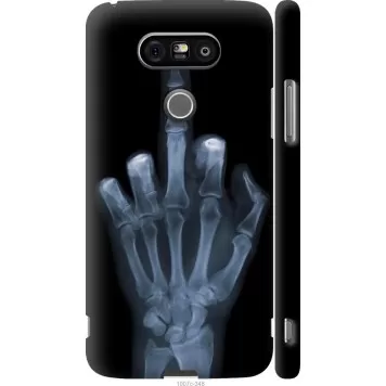 Чохол на LG G5 H860 Рука через рентген