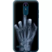 Чохол на LG K8 2018 Рука через рентген