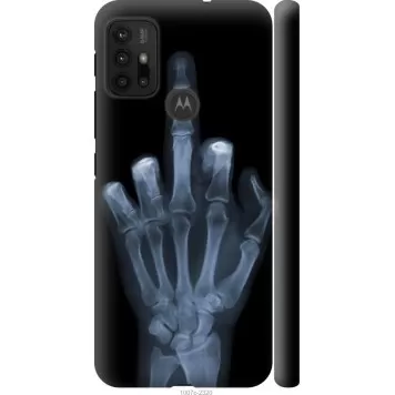 Чехол на Motorola Moto G30 Рука через рентген
