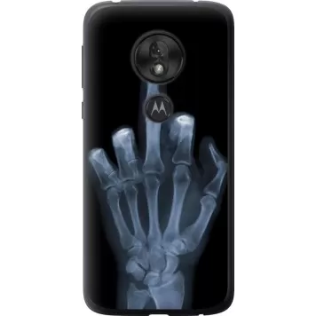 Чохол на Motorola Moto G7 Play Рука через рентген