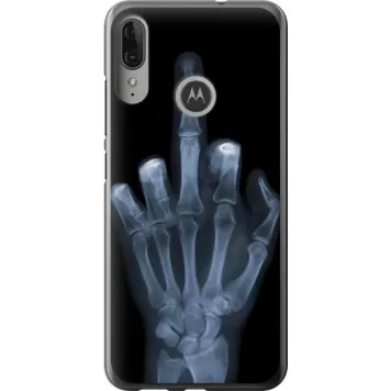 Чехол на Motorola Moto E6 Plus Рука через рентген