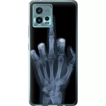 Чехол на Motorola G72 Рука через рентген