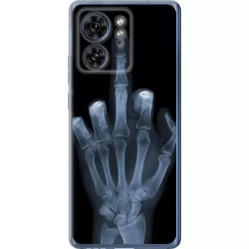 Чехол на Motorola Edge 40 Рука через рентген
