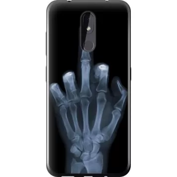 Чехол на Nokia 3.2 Рука через рентген