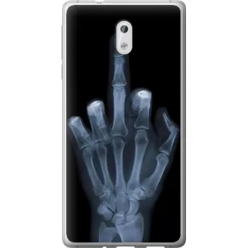 Чехол на Nokia 3 Рука через рентген