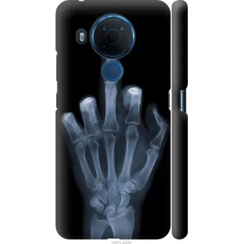 Чехол на Nokia 5.4 Рука через рентген