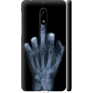 Чохол на Nokia 6 Рука через рентген