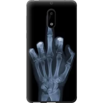 Чехол на Nokia 6 Рука через рентген