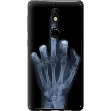 Чохол на Nokia 7 Рука через рентген