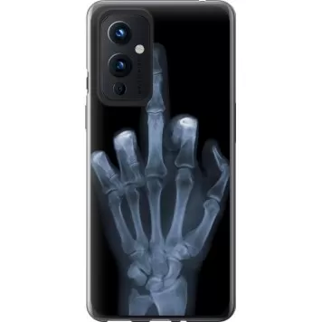 Чехол на OnePlus 9 Рука через рентген