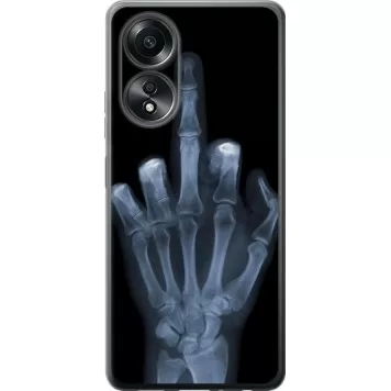 Чохол на Oppo A58 4G Рука через рентген