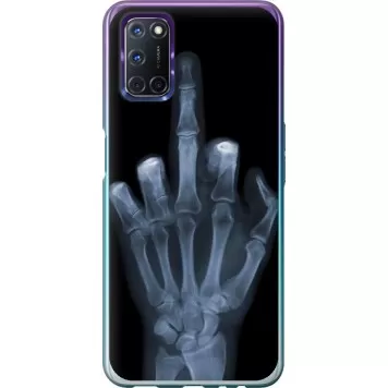 Чохол на Oppo A72 Рука через рентген