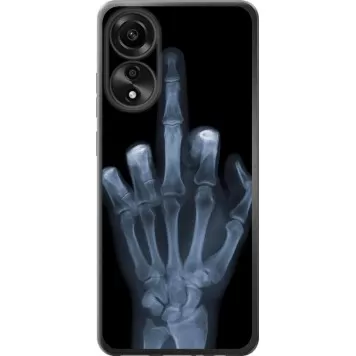 Чохол на Oppo A78 4G Рука через рентген