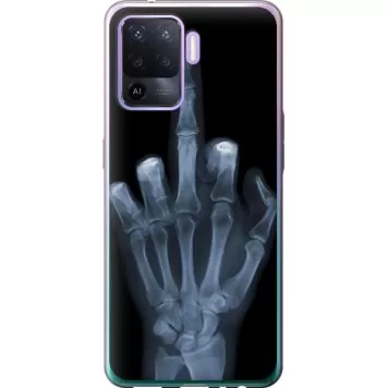Чехол на Oppo Reno5 Lite Рука через рентген