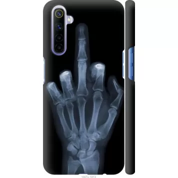 Чехол на Realme 6 Рука через рентген