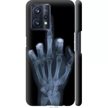 Чехол на Realme 9 Pro Plus Рука через рентген