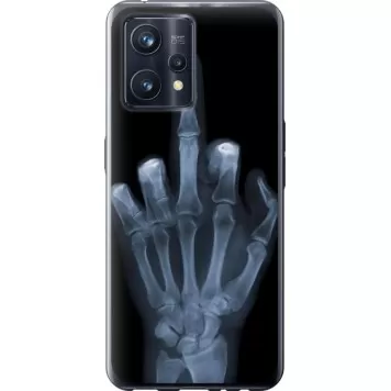 Чохол на Realme 9 Рука через рентген