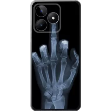 Чехол на Realme C53 Рука через рентген