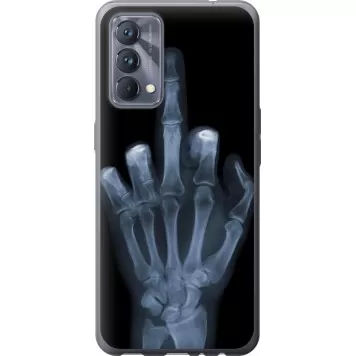 Чохол на Realme GT Master Рука через рентген