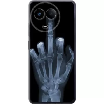 Чехол на Realme Realme 11 5G Рука через рентген