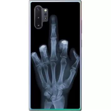 Чехол на Samsung Galaxy Note 10 Plus Рука через рентген