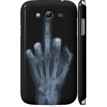 Чохол на Samsung Galaxy Grand Neo I9060 Рука через рентген