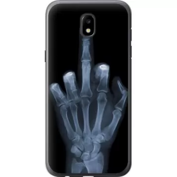 Чохол на Samsung Galaxy J5 J530 (2017) Рука через рентген