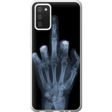Чохол на Samsung Galaxy A02s A025F Рука через рентген