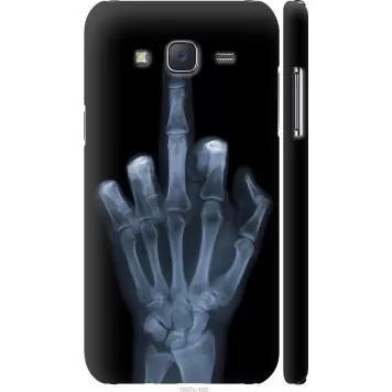 Чехол на Samsung Galaxy J5 (2015) J500H Рука через рентген